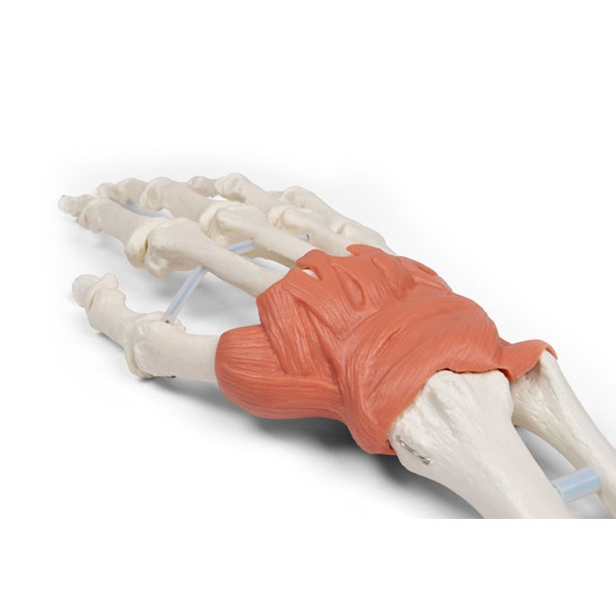 Pols met ligamentaire structuur - afbeelding 4