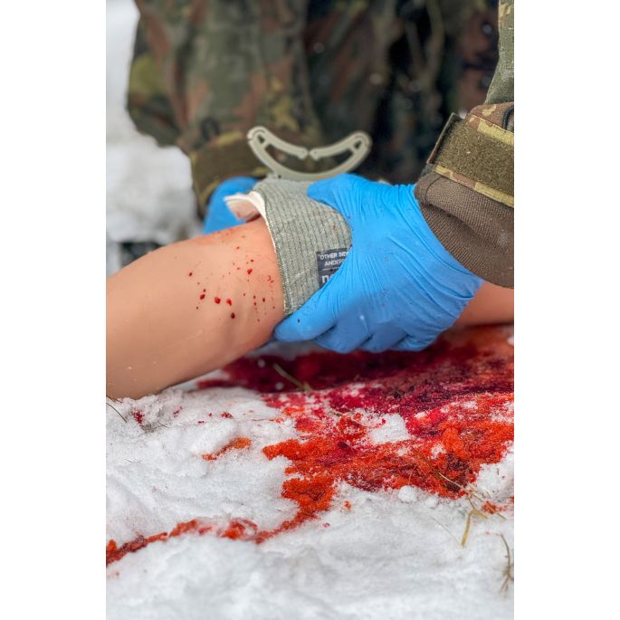 Trauma Tina, arm met sterk bloedende wonden
