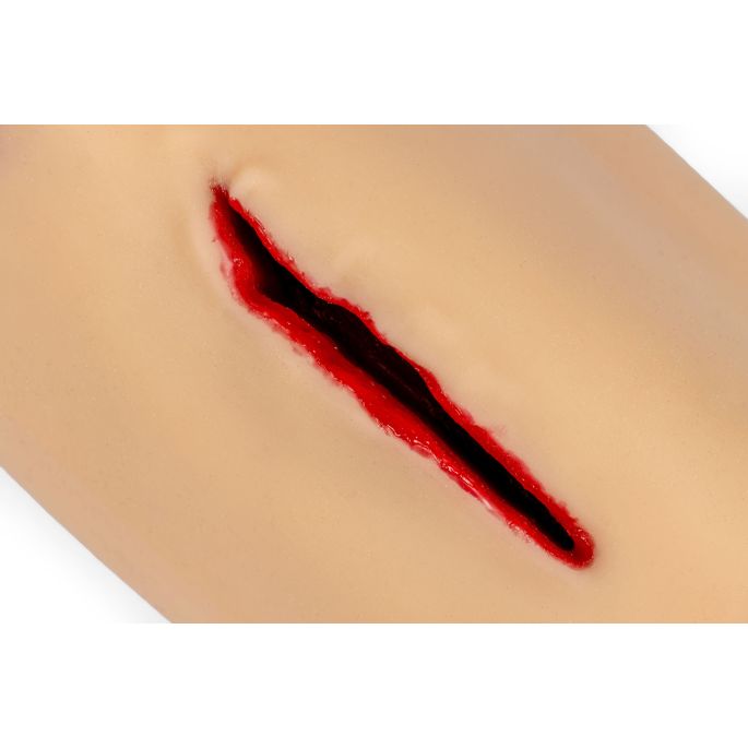 Trauma Tim, been met sterk bloedende wonden