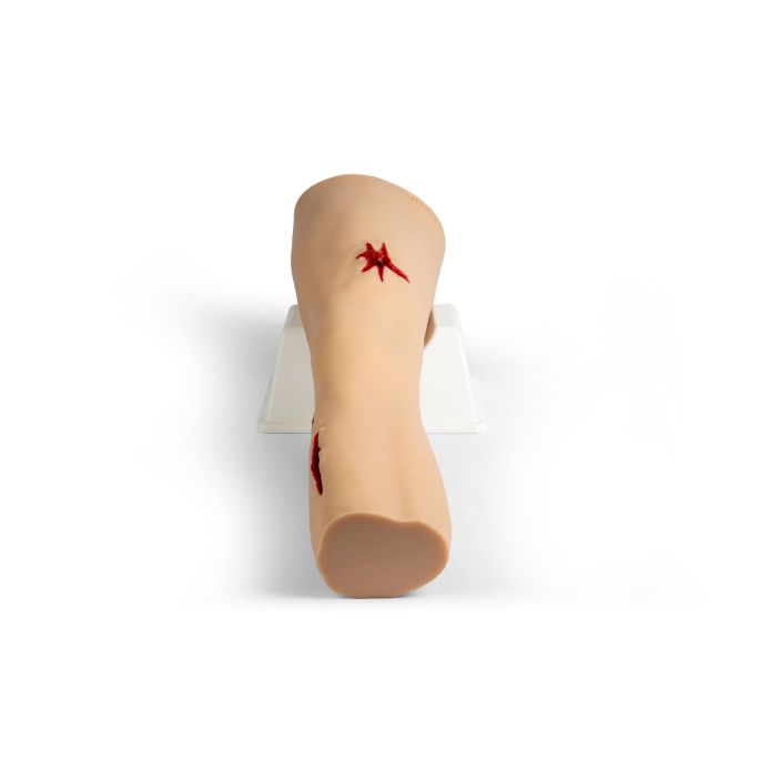 Trauma Tim, been met sterk bloedende wonden