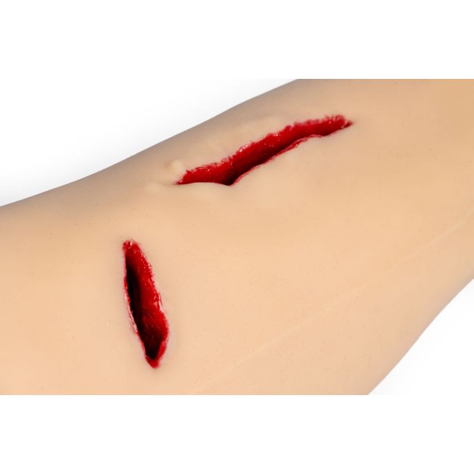 Trauma Tim, been met sterk bloedende wonden