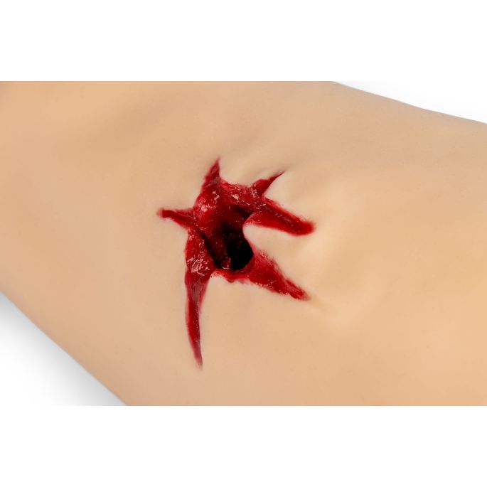 Trauma Tim, been met sterk bloedende wonden