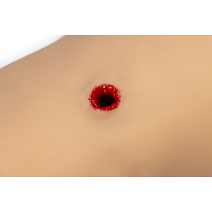 Trauma Tina, arm met sterk bloedende wonden