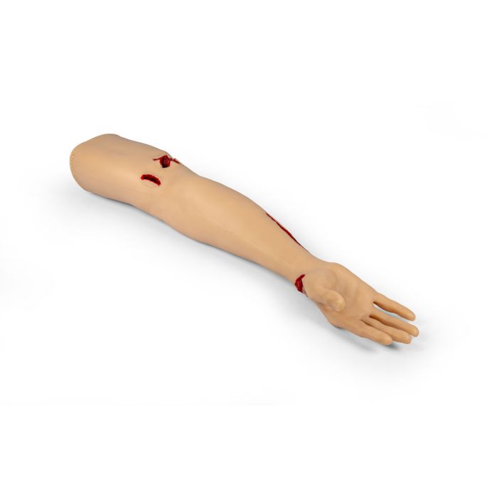 Trauma Tina, arm met sterk bloedende wonden