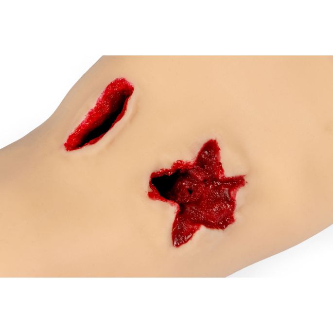 Trauma Tina, arm met sterk bloedende wonden