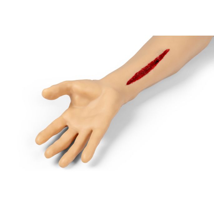 Trauma Tina, arm met sterk bloedende wonden