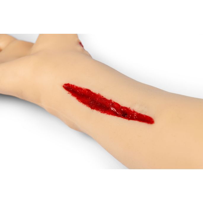 Trauma Tina, arm met sterk bloedende wonden