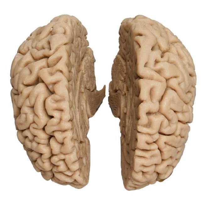 Human Brain, echte cast