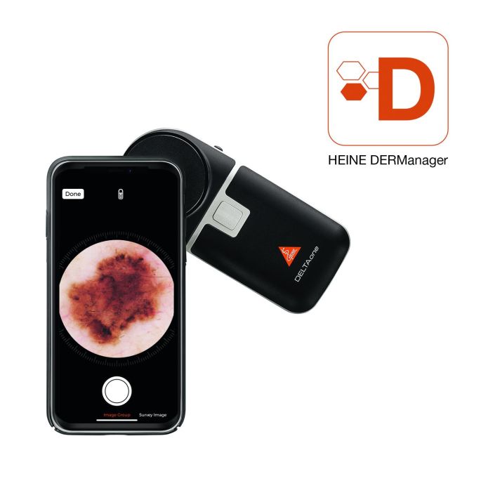 Heine DELTAone dermatoscoop met contactplaat met schaalverdeling, USB-kabel, netadapter, harde koffer