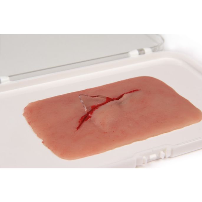 Wondmoulage 'gesneden met glasfragment'