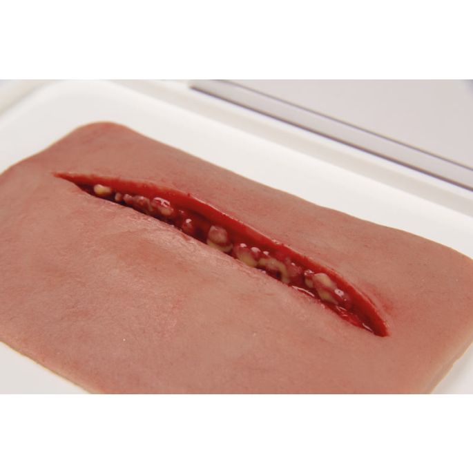 Wondmoulage 'Cut'
