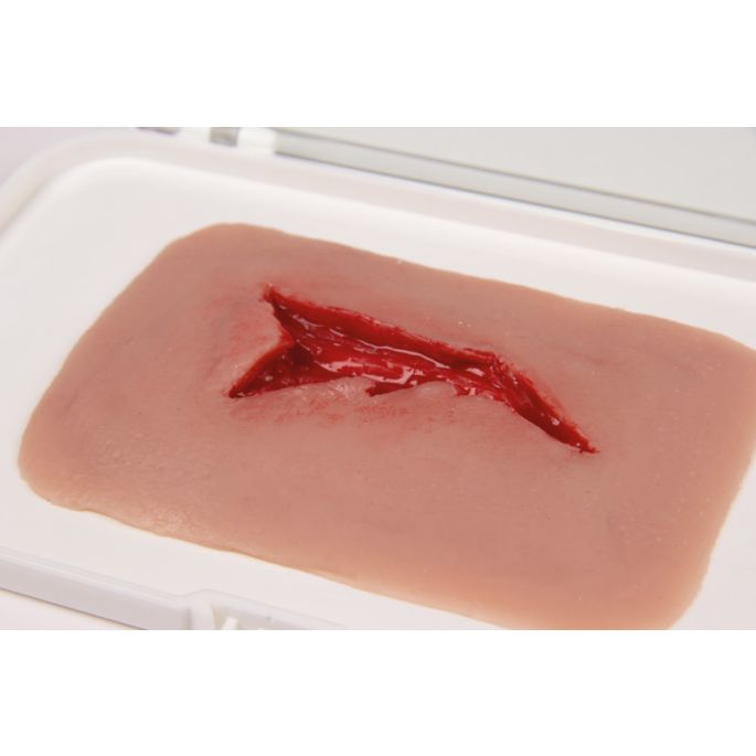 Wondmoulage 'laceratie'