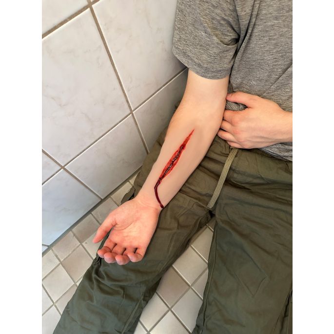 Wondmoulage Zelfmoordpoging