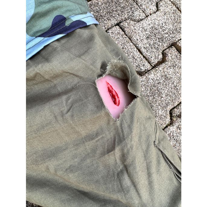 Wondmoulage steek dij