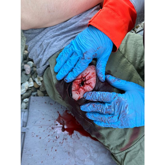 Wondmoulage Shot Lies, Wondverpakking
