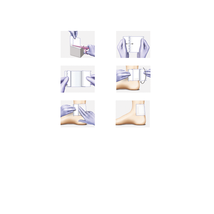 Omnifix Elastic 20 cm x 10 m