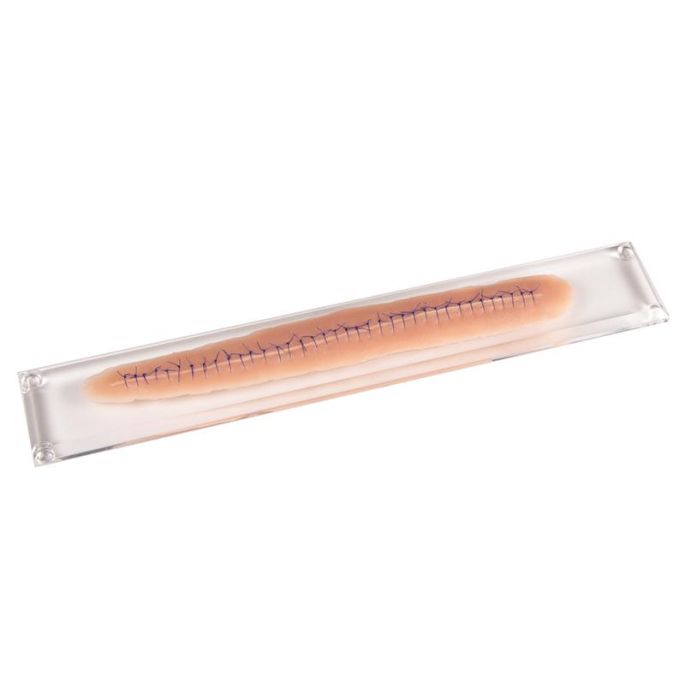 Chirurgische wond, met hechting, 22 cm