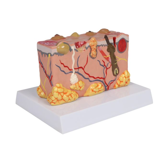 Pathologisch huidmodel
