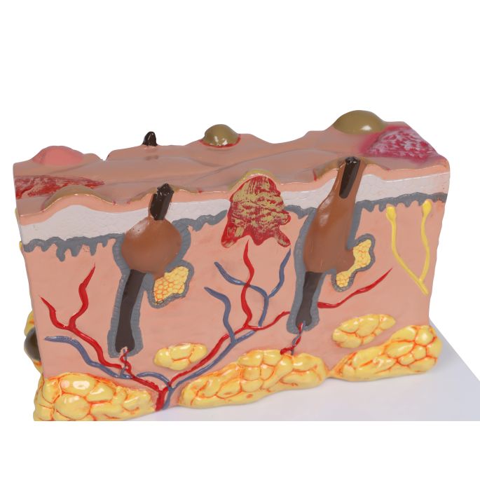 Pathologisch huidmodel