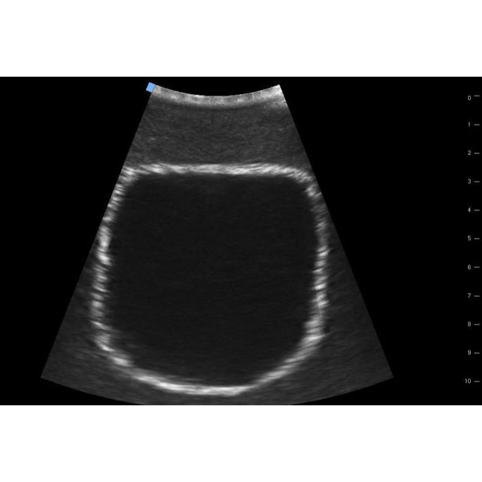 SonoEZ echografietrainer 'Urineblaas'