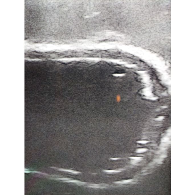 Echografie trainer hondenblaas