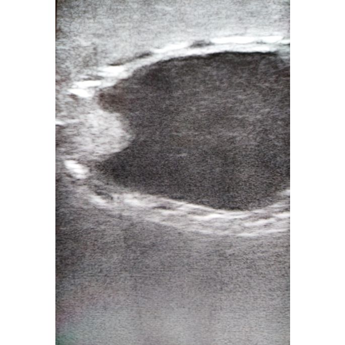 Echografie trainer hondenblaas