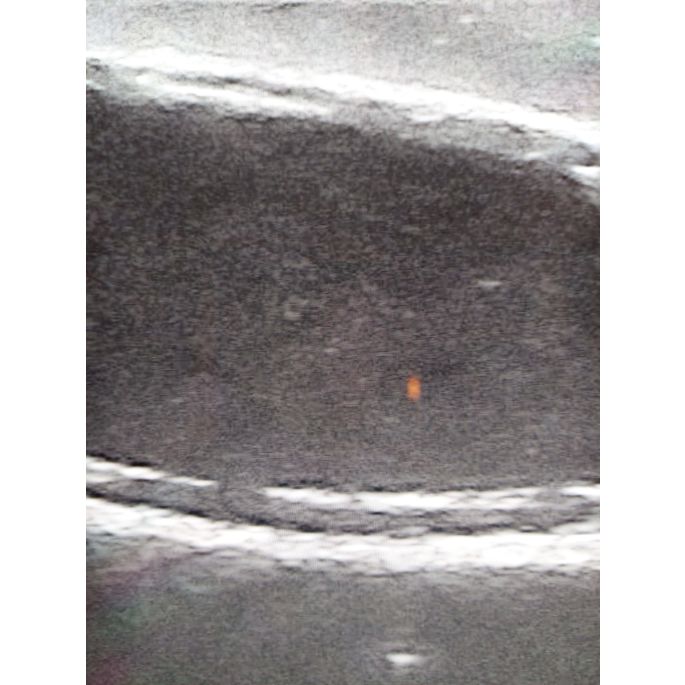 Echografie trainer hondenblaas