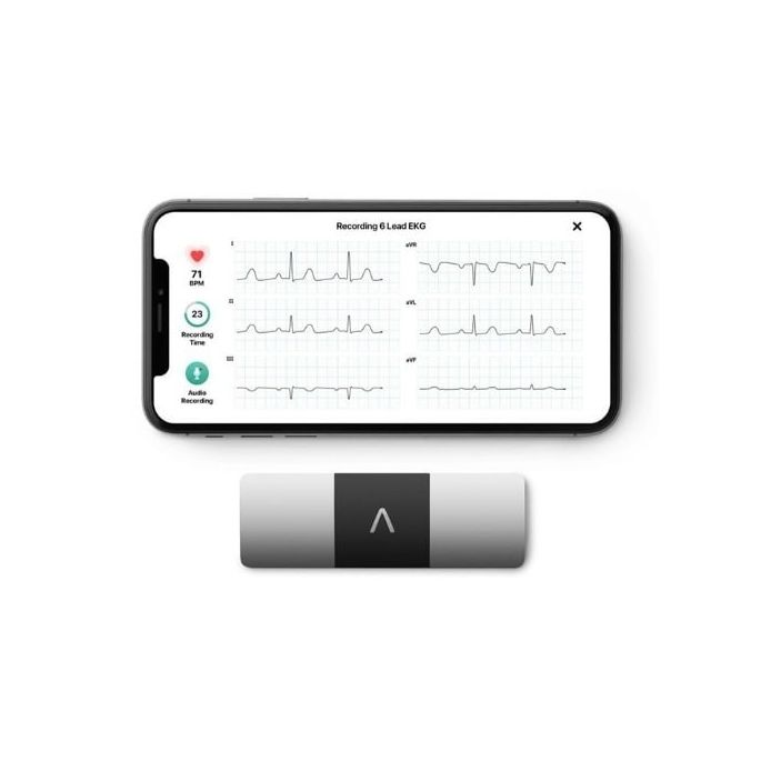 AliveCor KardiaMobile 6L ECG