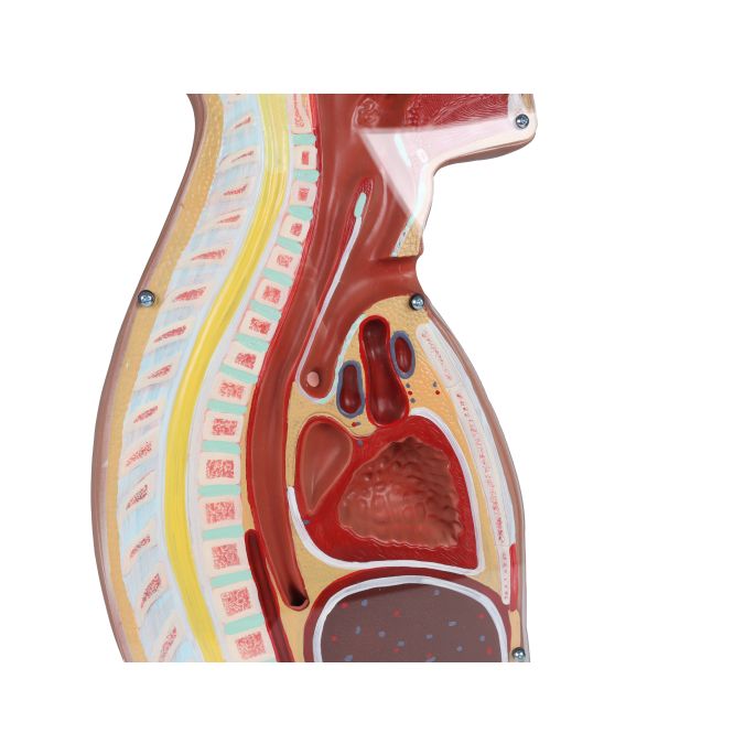 NG & Tracheostomie Torso - afbeelding 5
