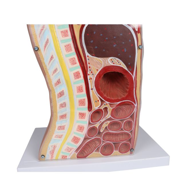 NG & Tracheostomie Torso - afbeelding 6