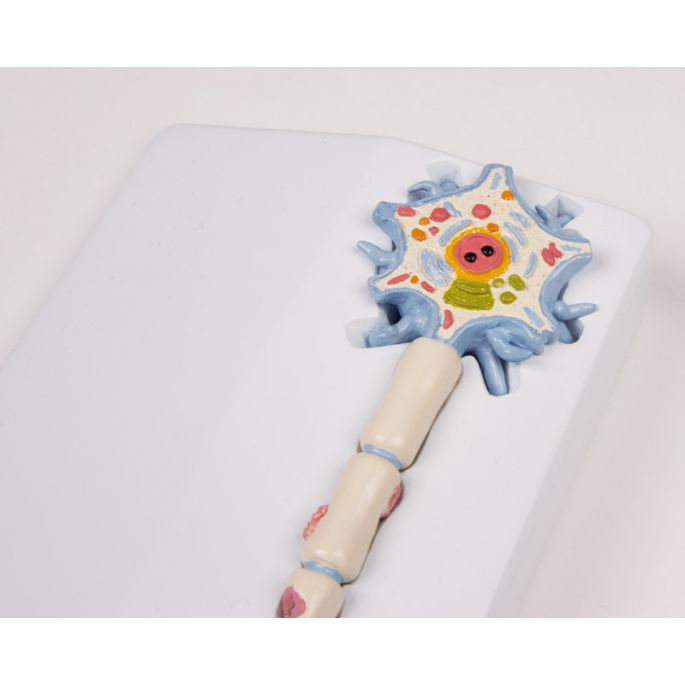 Neuronmodel met stadia van multiple sclerose - afbeelding 2