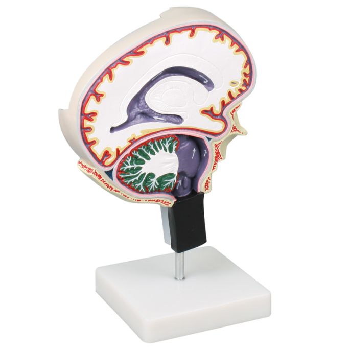 Cerebrospinale vloeistofcirculatie - afbeelding 2