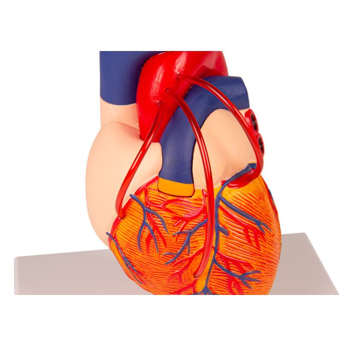 Hart met bypass - afbeelding 2