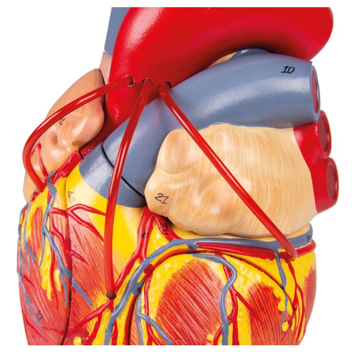 Hart met Bypass