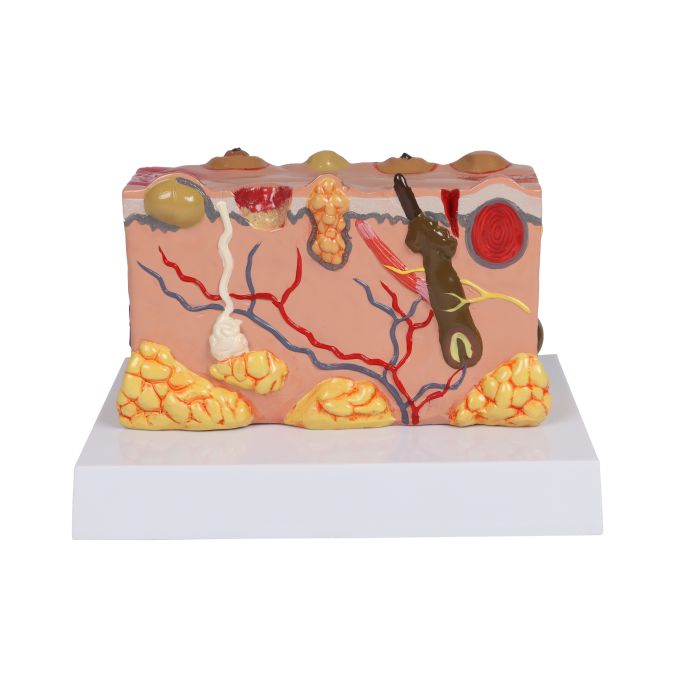 Pathologisch huidmodel - afbeelding 3