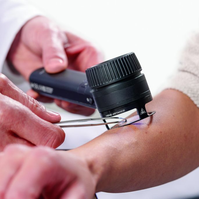 HEINE diSTANCE werkingsring voor dermatoscopisch onderzoek zonder huidcontact met de DELTA 30 en DELTA 30 PRO