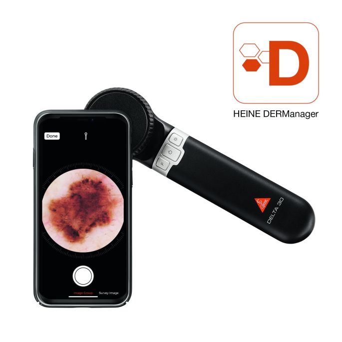 HEINE DELTA 30 dermatoscoop met contactplaat met schaalverdeling, USB-kabel, netadapter en harde koffer