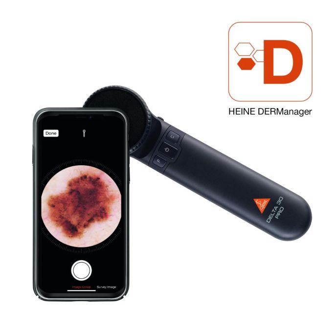 Heine DELTA 30 PRO dermatoscoop met uitgebreide accessoires (incl. smartphone-adapter)