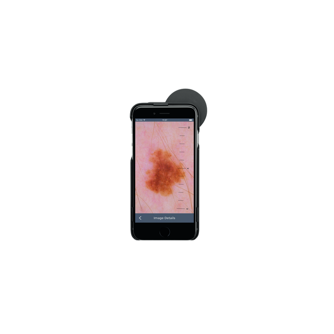 HEINE iC1 digitale dermatoscoop set met contactplaat met schaalverdeling, smartphone-case iC1/6 voor Apple iPhone 6 en 6s, USB-kabel en medisch goedgekeurde voeding