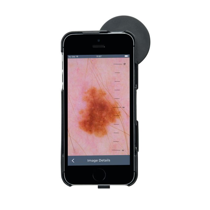 HEINE iC1 digitale dermatoscoop set met contactplaat met schaalverdeling, smartphone-case iC1/5 voor Apple iPhone 5s en SE (1e generatie), USB-kabel en medisch goedgekeurde voeding