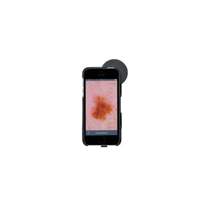 HEINE iC1 digitale dermatoscoop set met contactplaat met schaalverdeling, smartphone-case iC1/5 voor Apple iPhone 5s en SE (1e generatie), USB-kabel en medisch goedgekeurde voeding