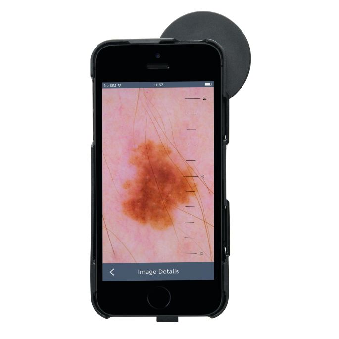 HEINE iC1 digitale dermatoscoop set met contactplaat met schaalverdeling, smartphone-case iC1/7 voor Apple iPhone 7, 8 en SE (2e generatie), USB-kabel en medisch goedgekeurde voeding