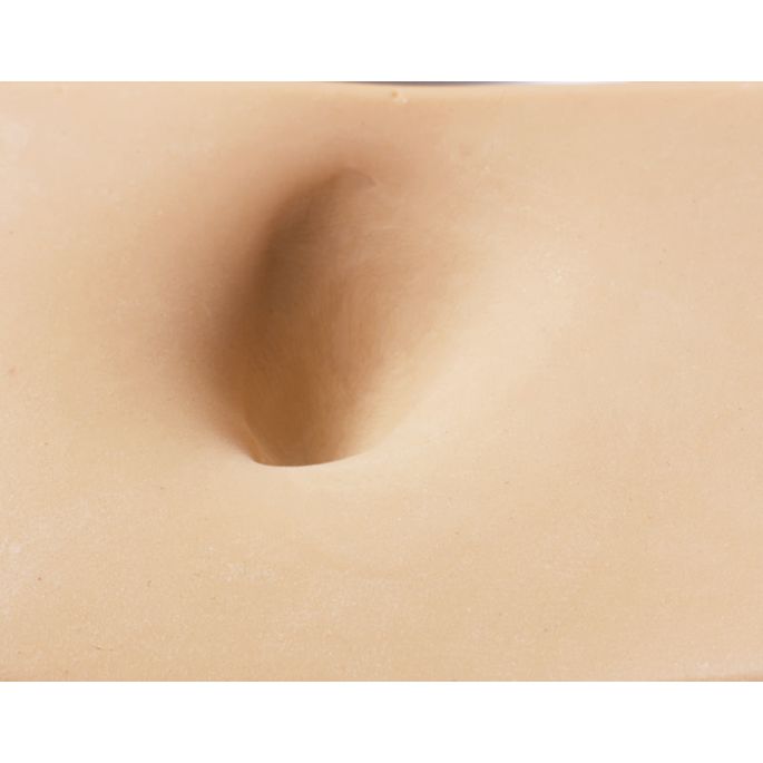 Oedeemvoet met diep weefselletsel voor GERI/KERI - afbeelding 4