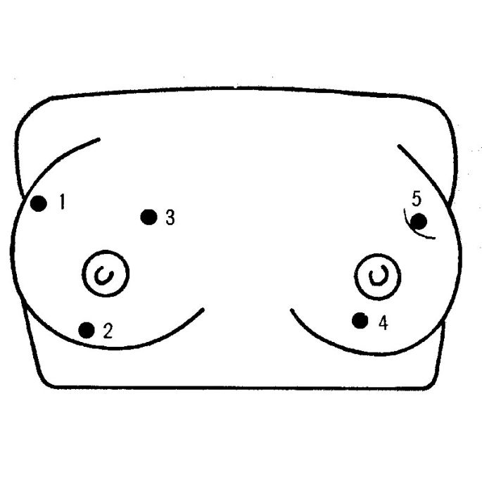 Palpatiemodel voor borstkanker (V2) - afbeelding 2