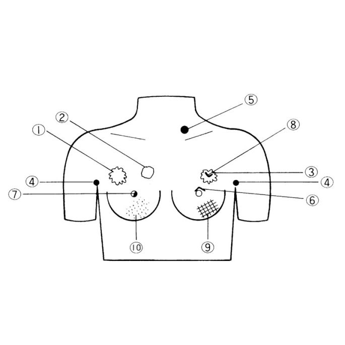 Palpatiemodel voor borstkanker (V3) - afbeelding 2