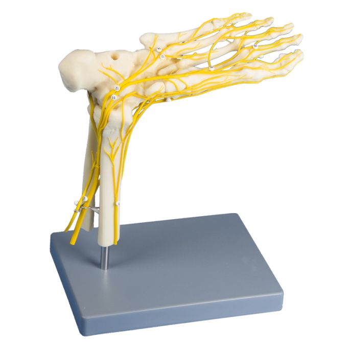 Neuro-voet - afbeelding 2