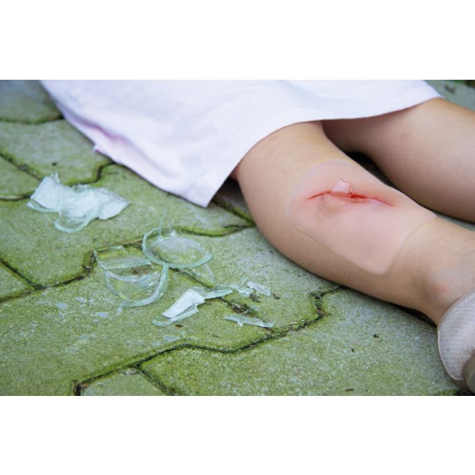 Wondmoulage 'gesneden met glasfragment' - afbeelding 7