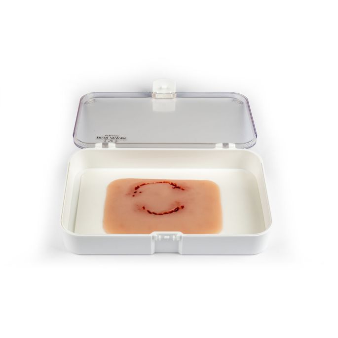 Wondmoulage 'menselijke beet' - afbeelding 2
