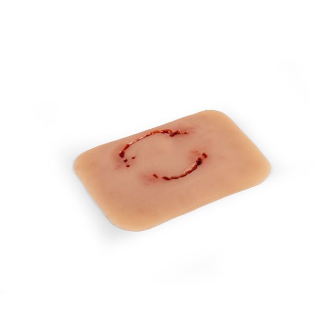 Wondmoulage 'menselijke beet' - afbeelding 3