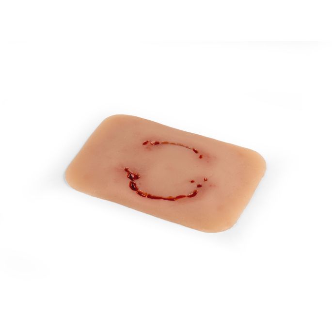 Wondmoulage 'menselijke beet' - afbeelding 4